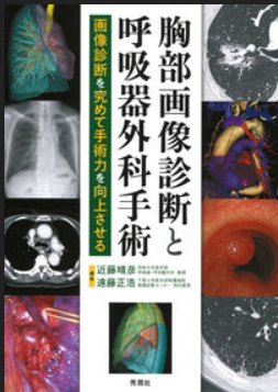 胸部画像診断と呼吸器外科手術 : 画像診断を究めて手術力を向上させる